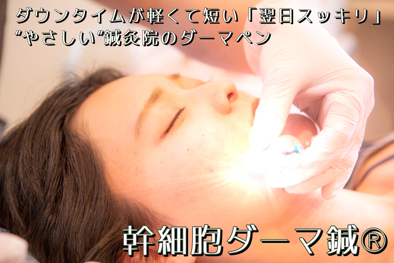 ★幹細胞ダーマ鍼★の画像