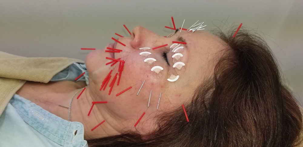メニューの写真